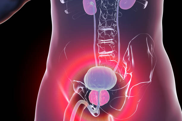 how to avoid prostate cancer, what are the 5 warning signs of prostate cancer?, prostate cancer symptoms, prostate cancer causes, prostate cancer surgery, prostate cancer treatment, prostate cancer stages,